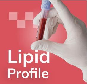 carousel_card_banner_img_Lipid Test: 5 Important Questions Answered